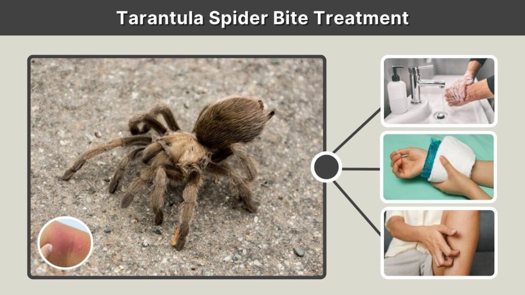 Tarantula Spider Bite Treatment