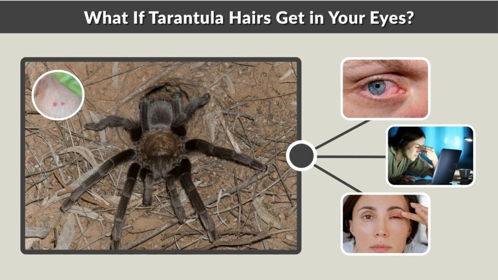 What If Tarantula Hairs Get in Your Eyes?