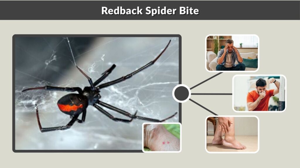 Redback Spider Bite