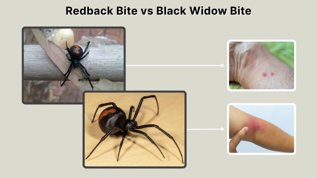 Redback Bite vs Black Widow Bite
