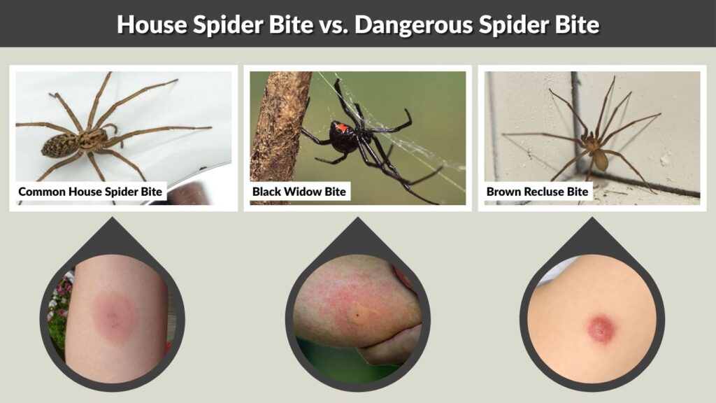House Spider Bite vs. Dangerous Spider Bite