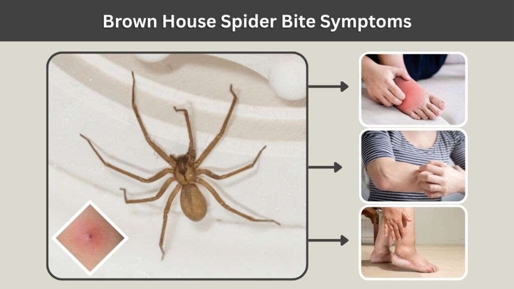 Brown House Spider Bite Symptoms