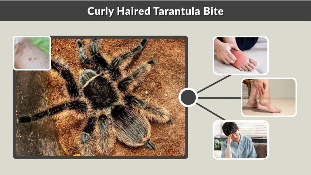Curly Haired Tarantula Bite