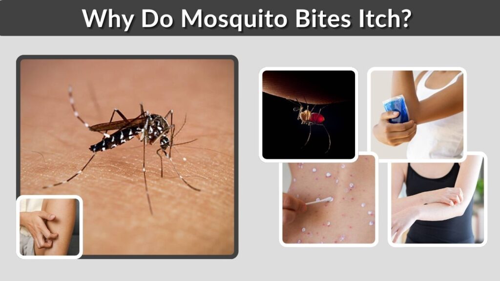 Why Do Mosquito Bites Itch? Causes, Reactions, and How to Stop It