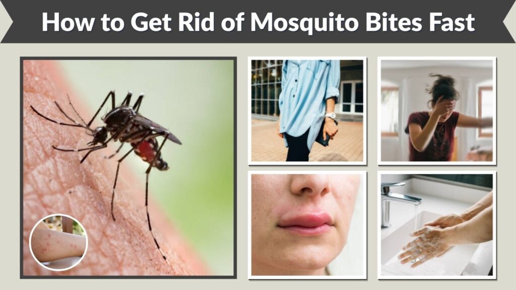 How to Get Rid of Mosquito Bites Fast and Stop the Itch