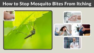 How to Stop Mosquito Bites From Itching: 6 Ways