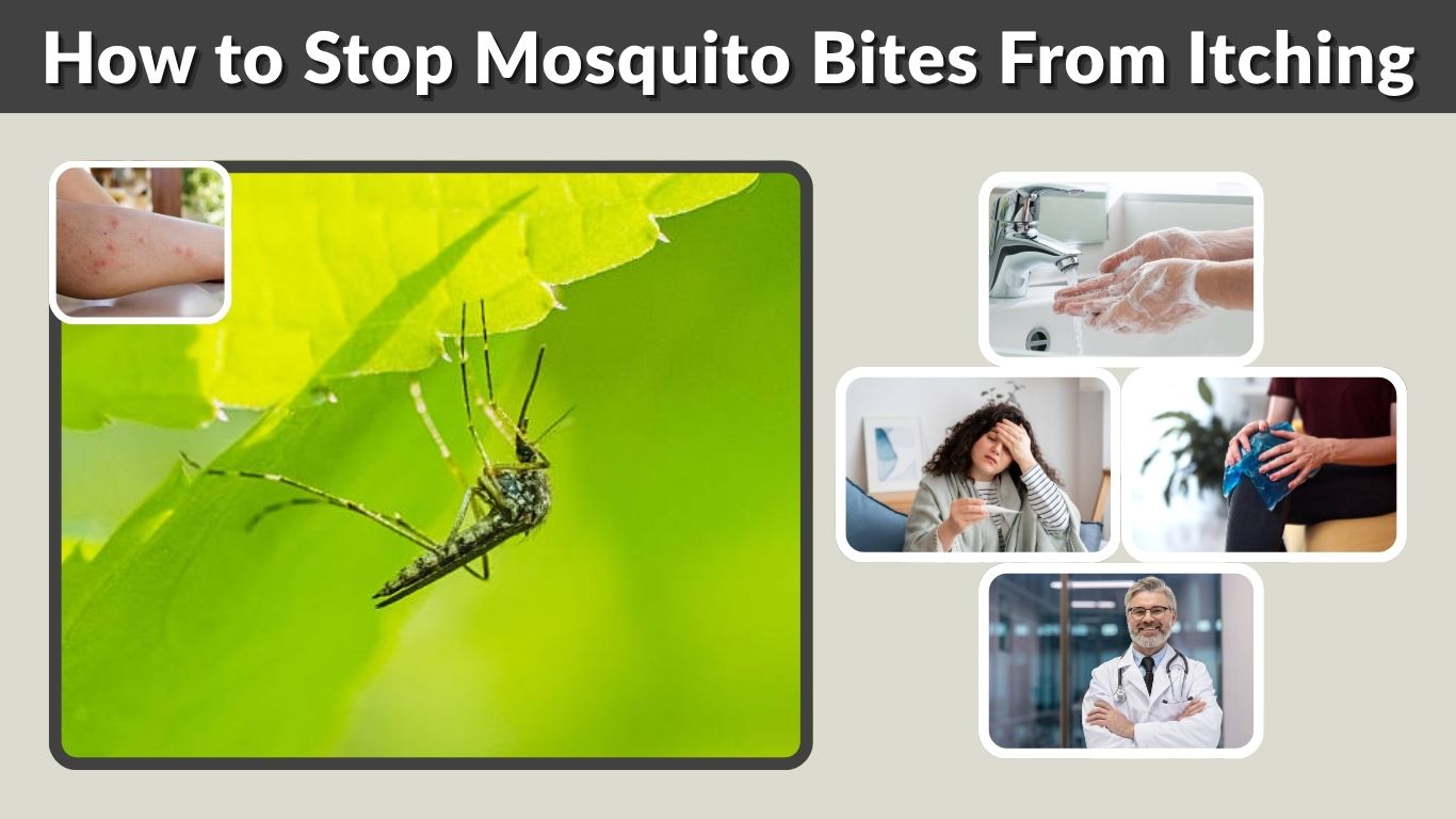 How to Stop Mosquito Bites From Itching: 6 Ways