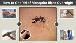 How to Get Rid of Mosquito Bites Overnight: Fast Relief