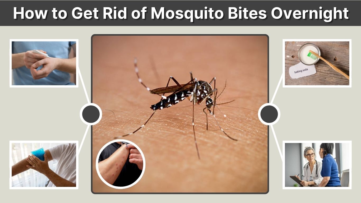 How to Get Rid of Mosquito Bites Overnight: Fast Relief