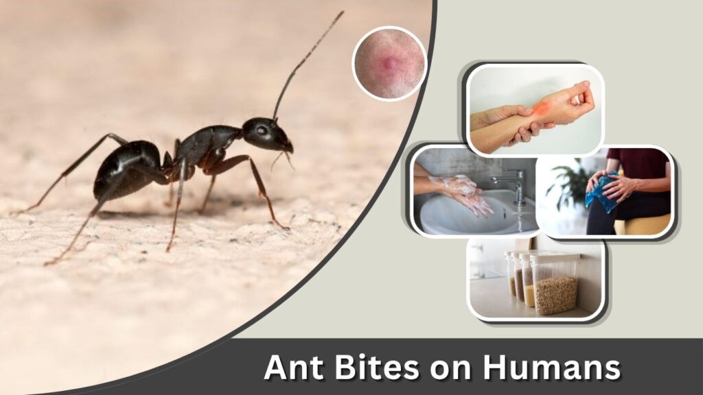 Ant Bites on Humans: Symptoms, Pictures, and Treatment