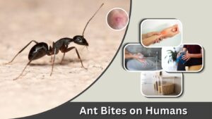 Ant Bites on Humans: Symptoms, Pictures, and Treatment