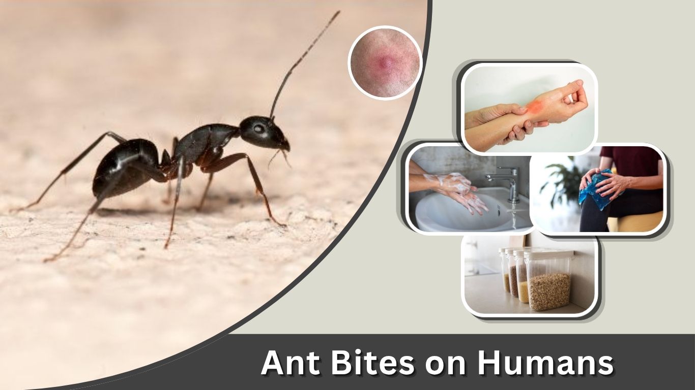 Ant Bites on Humans: Symptoms, Pictures, and Treatment