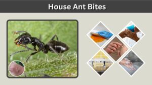 House Ant Bites: Symptoms, Treatment, and Prevention