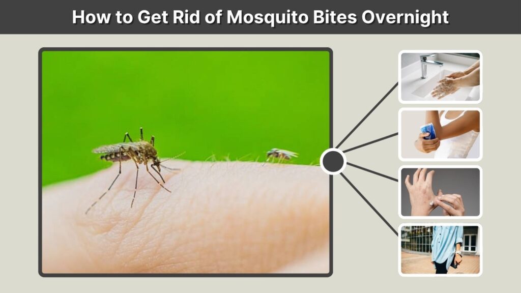 How to Get Rid of Mosquito Bites Overnight