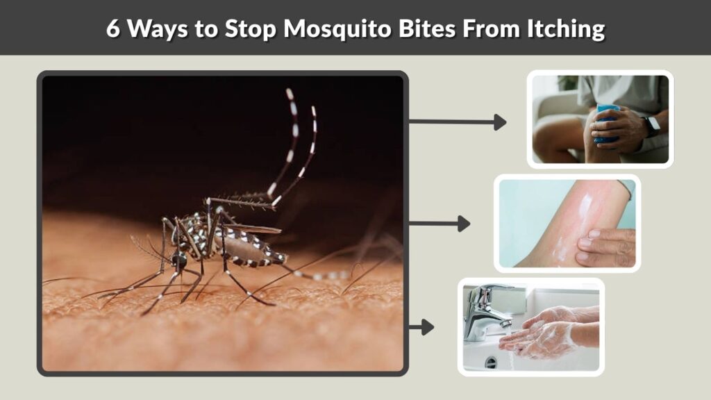 6 Ways to Stop Mosquito Bites From Itching