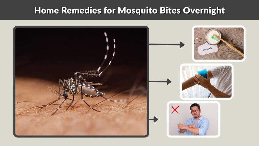 Home Remedies for Mosquito Bites Overnight