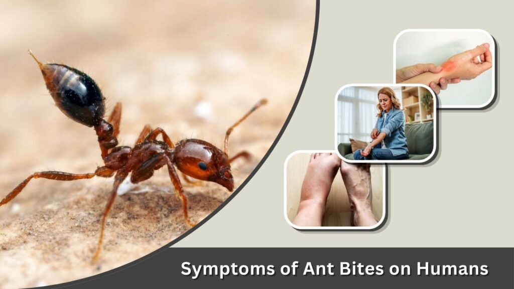 Symptoms of Ant Bites on Humans