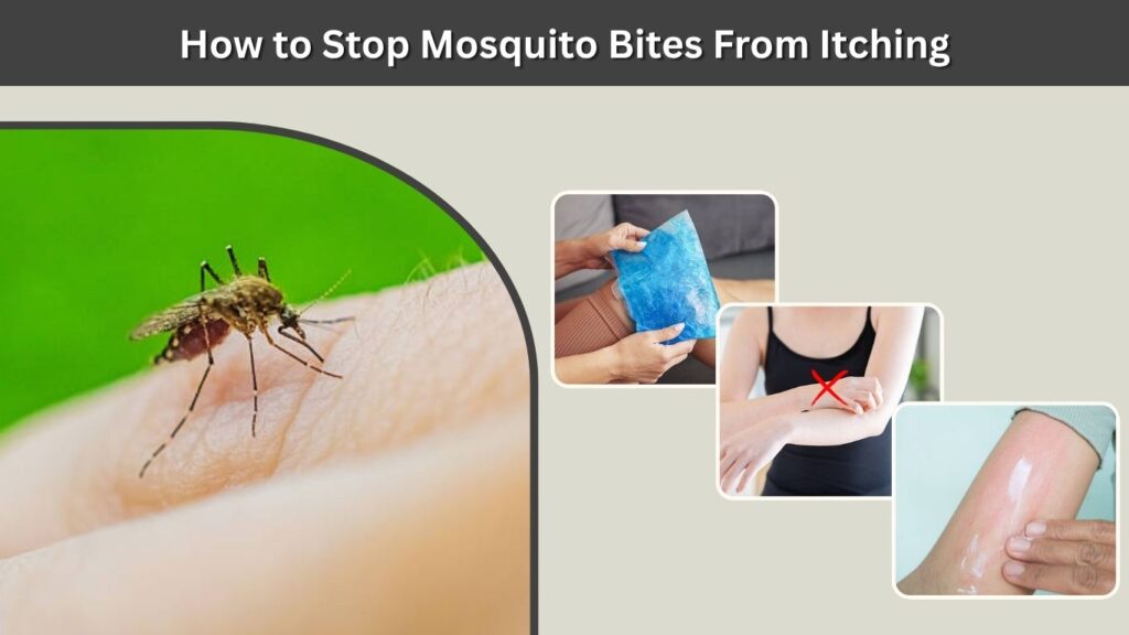 How to Stop Mosquito Bites From Itching