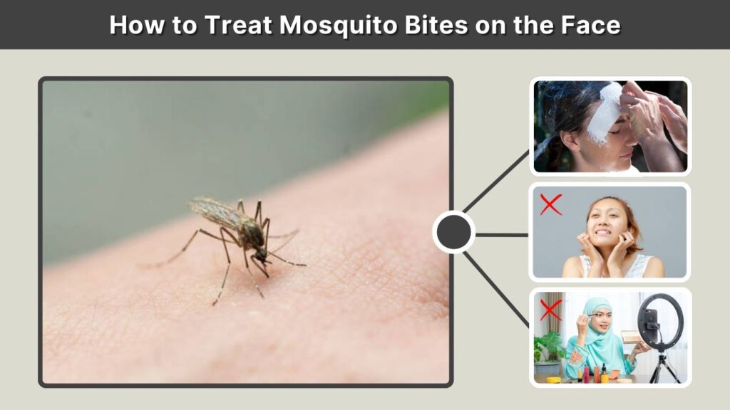How to Treat Mosquito Bites on the Face