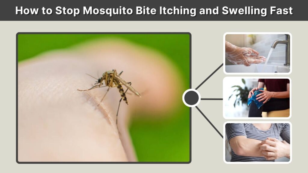 How to Stop Mosquito Bite Itching and Swelling Fast
