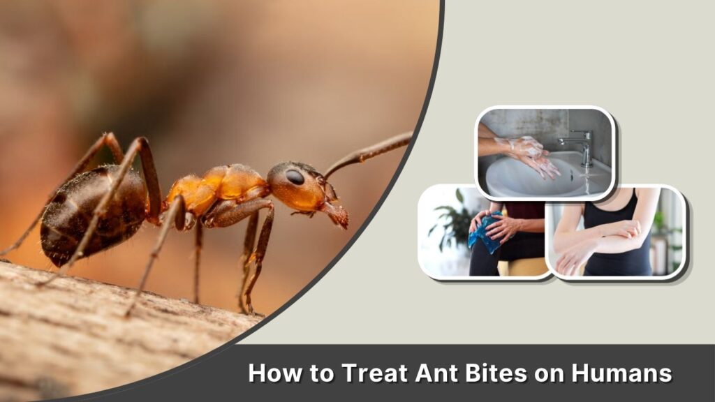 How to Treat Ant Bites on Humans
