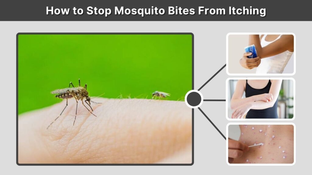 How to Stop Mosquito Bites From Itching