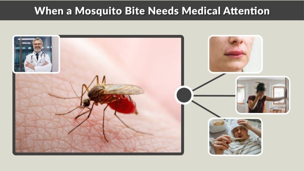 When a Mosquito Bite Needs Medical Attention
