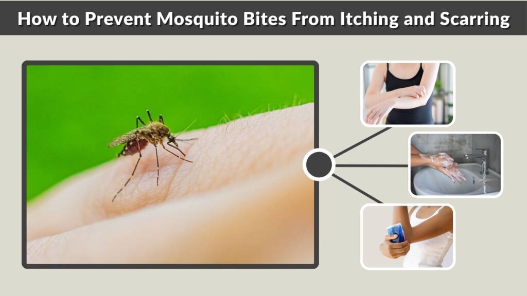 How to Prevent Mosquito Bites From Itching and Scarring