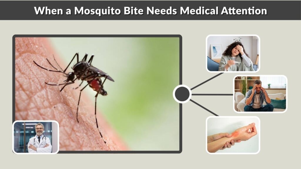 When a Mosquito Bite Needs Medical Attention