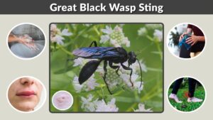 Great Black Wasp Sting: Pain, Symptoms & Treatment