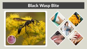 Black Wasp Bite: Symptoms, Treatment, Sting & Risks