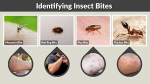 Identifying Insect Bites: 15 Common Bites and Signs With Pictures 