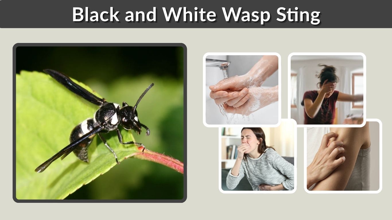 Black and White Wasp Sting: Symptoms, Treatment & Safety