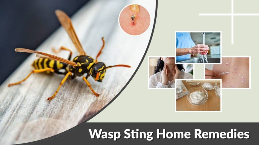 Wasp Sting Home Remedies: Safe Treatment and Relief