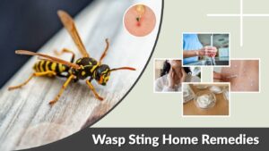 Wasp Sting Home Remedies: Safe Treatment and Relief