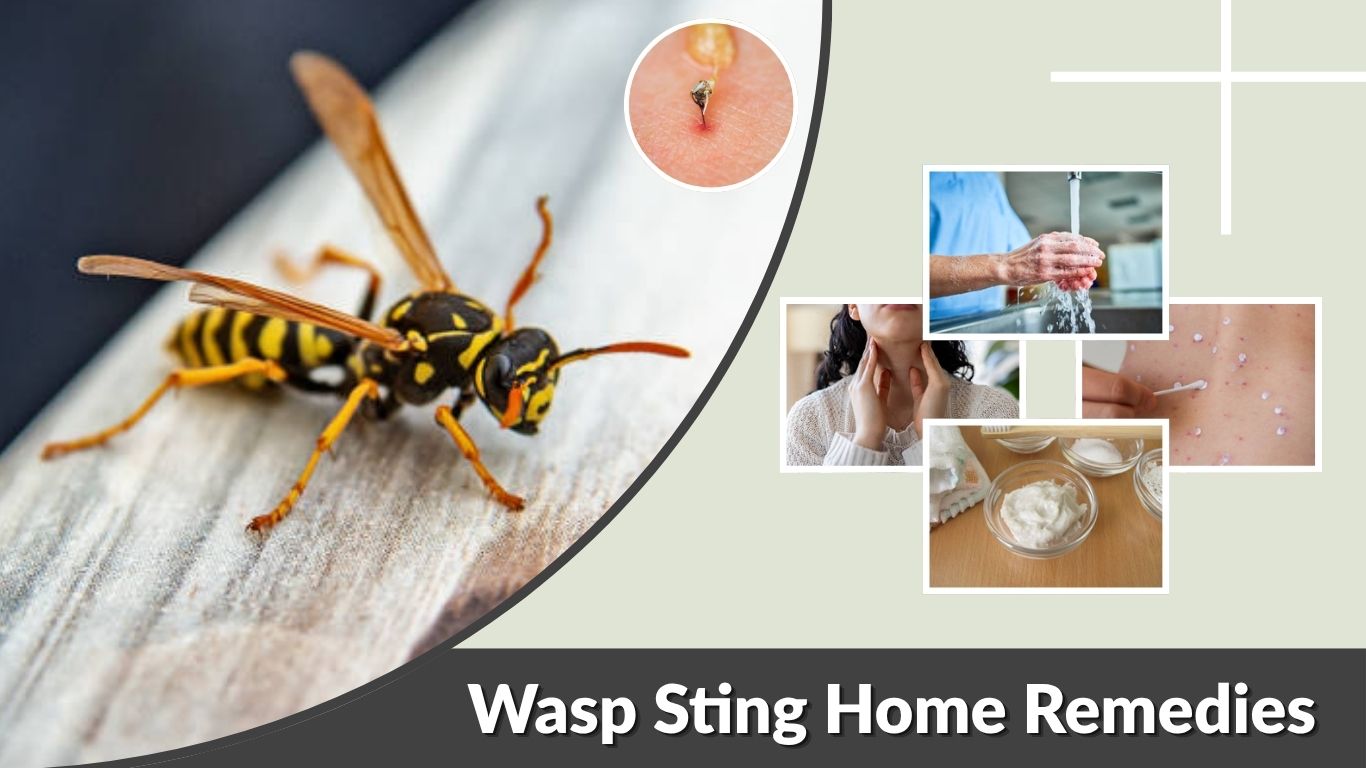 Wasp Sting Home Remedies: Safe Treatment and Relief