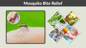 Mosquito Bite Relief: 10 Ways to Stop Itching Fast