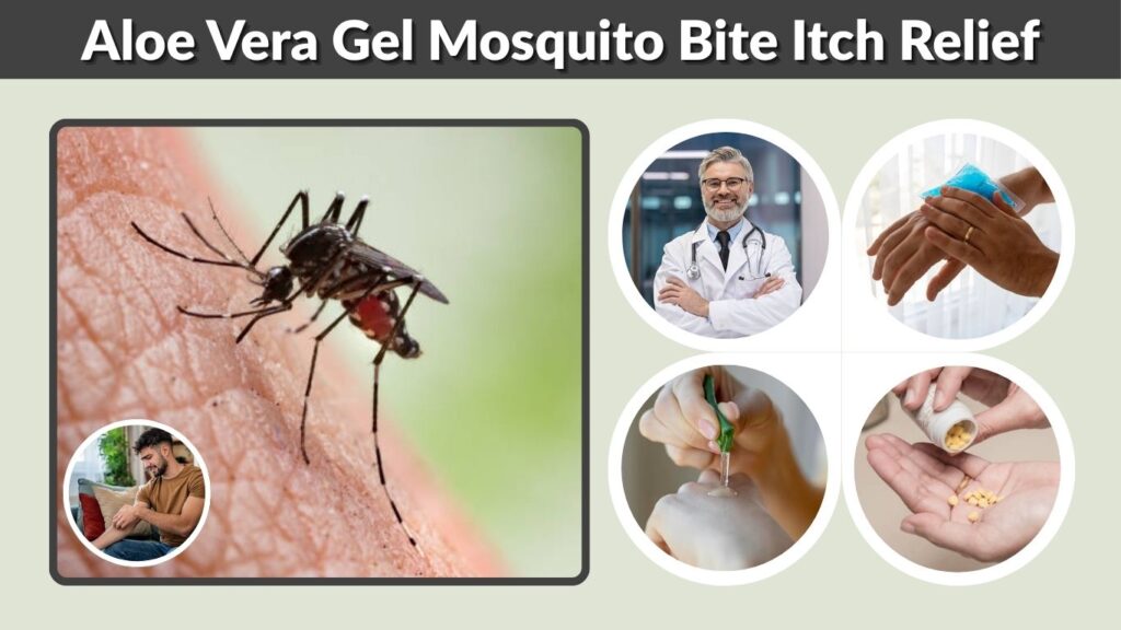 Aloe Vera Gel Mosquito Bite Itch Relief: What Evidence Says