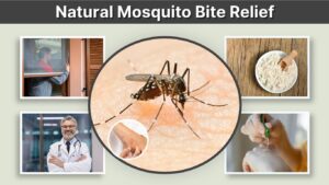 Natural Mosquito Bite Relief: 8 Ways to Stop Itching