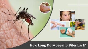 How Long Do Mosquito Bites Last? Healing Time and Relief