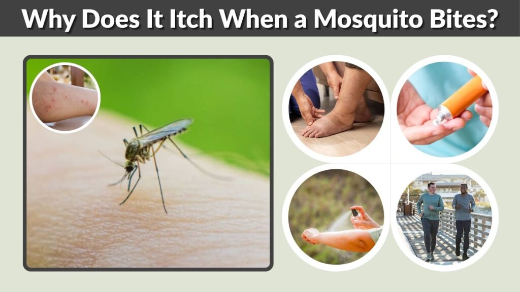 Why Does It Itch When a Mosquito Bites? Causes & Relief