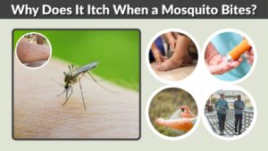 Why Does It Itch When a Mosquito Bites? Causes & Relief
