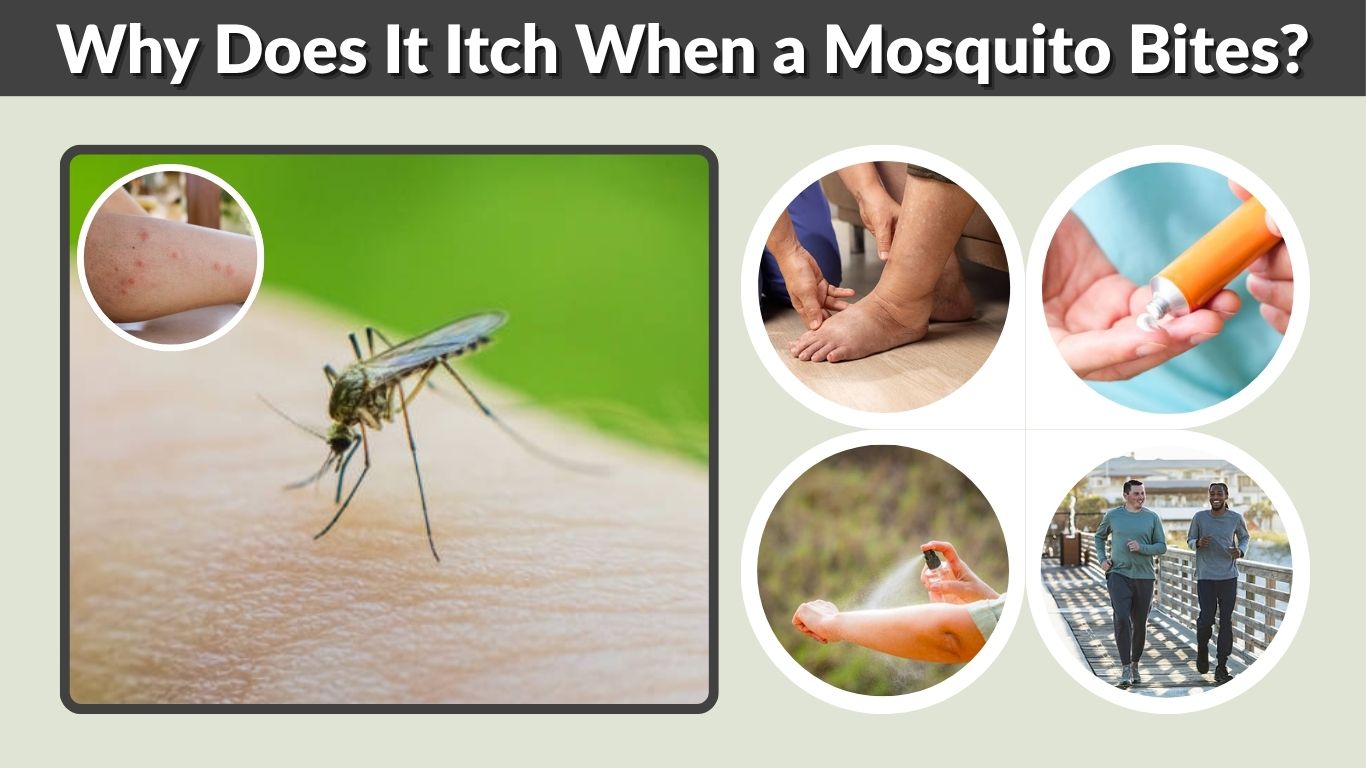 Why Does It Itch When a Mosquito Bites? Causes & Relief