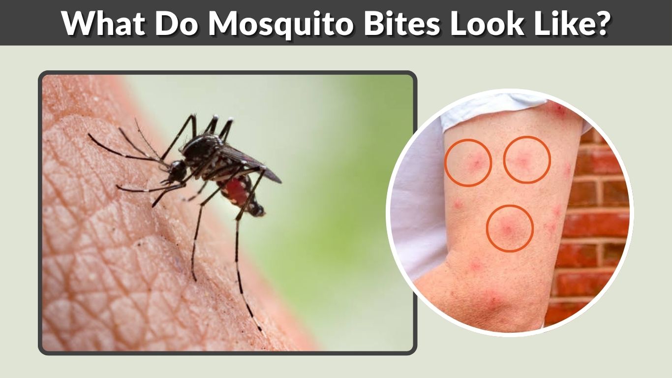 What Do Mosquito Bites Look Like? Signs & Pictures