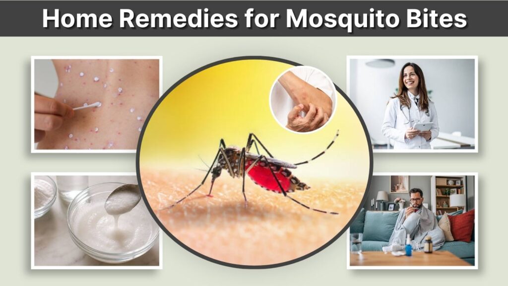 Home Remedies for Mosquito Bites: 8 Ways to Stop Itching