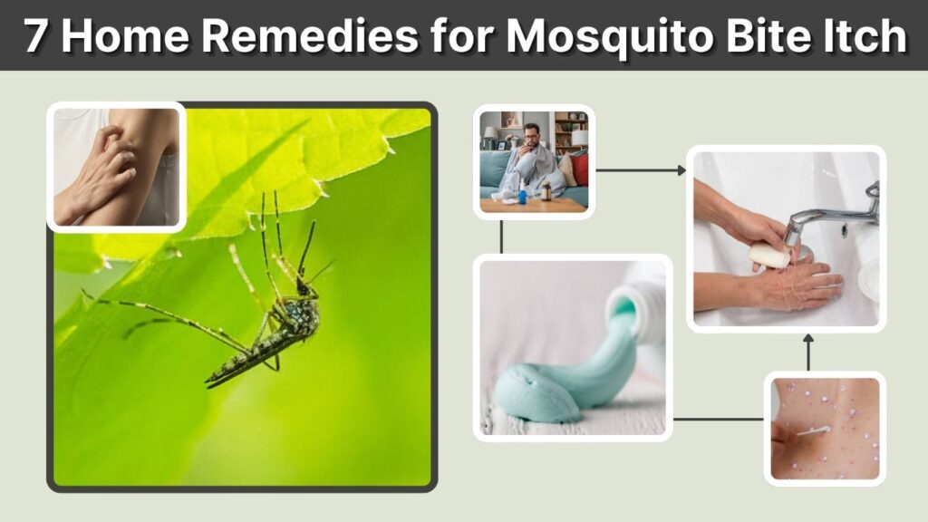 7 Home Remedies for Mosquito Bite Itch That Really Help