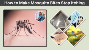 How to Make Mosquito Bites Stop Itching: 9 Easy Ways