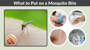 What to Put on a Mosquito Bite: Fast Ways to Stop Itching