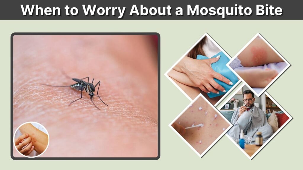 When to Worry About a Mosquito Bite: 9 Serious Warning Signs