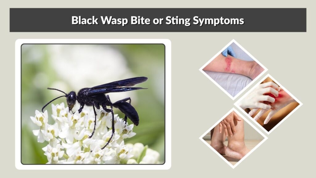 Black Wasp Bite or Sting Symptoms